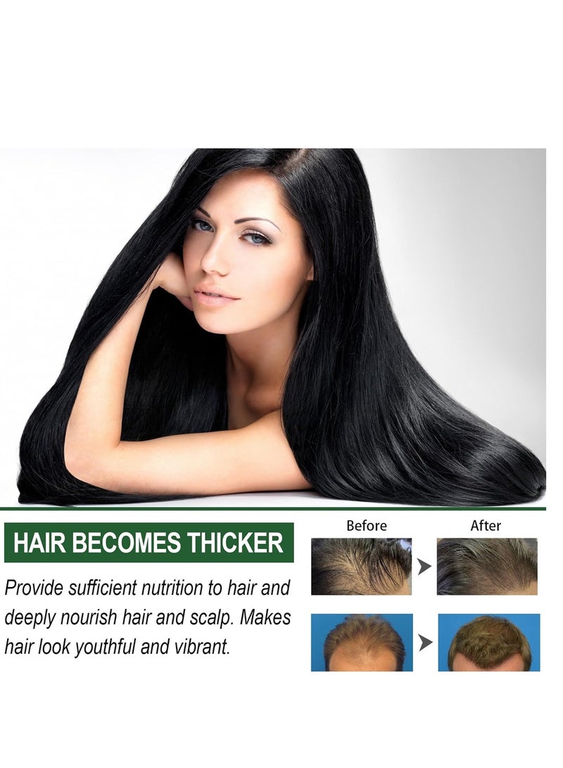 إيست مون شامبو نمو الشعر بالزنجبيل ، شامبو منشط الجذور ، شامبو مضاد لتساقط الشعر بالزنجبيل والسمسم ، شامبو نبات الزنجبيل لتخفيف حكة فروة الرأس الجافة ، يعزز نمو الشعر وينعم 100 مل - Image 3