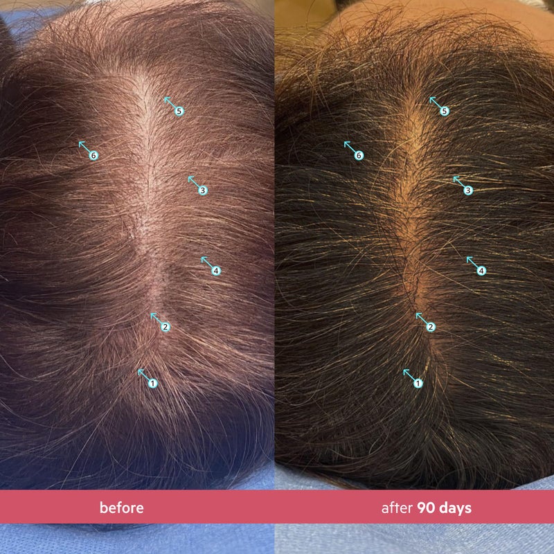 DS LABORATORIES DS Labs Spectral Womenâ€™s Hair Density Serum (formerly Spectral.CSF), 60mL - Lightweight Leave-In for Fuller, Thicker Looking Hair, Fast Absorbing, Non-Greasy, For All Hair Types - Image 3