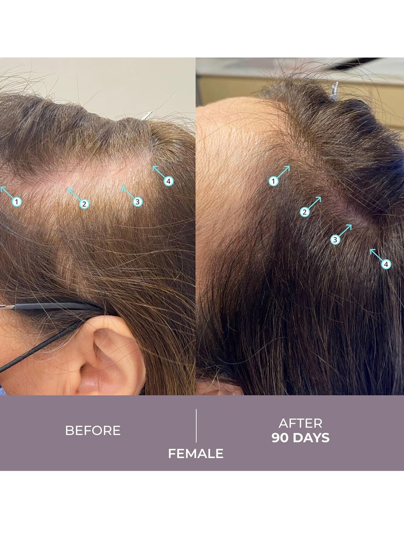 DS LABORATORIES DS Laboratories Spectral.CSF Hair Regrowth Treatment for Women - Biotin Serum for Hair Growth, Thinning, and Thickening  - Image 4