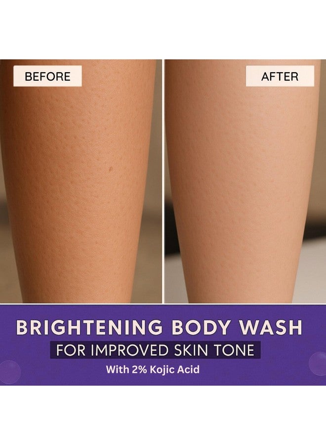 BAKE 2% Kojic Acid Brightening Body Wash with Glycolic Acid & Alpha Arbutin | De-Tan Body Wash | For Pigmentation & Tan Removal | For Dark Knees & Elbows | Dark Spots & Sun Damage | For Men & Women - 250ml (Blueberry) - Image 3