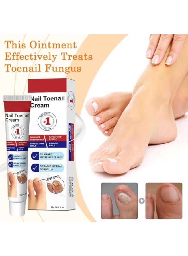 ديرمفري ® Fungal Nail Treatment Cream, Antifungal For Toenails, Paronychia & Yellow Damaged Nail Repair, Natural Botanical Formula, Deep Care & Long-Lasting Protection - Image 2