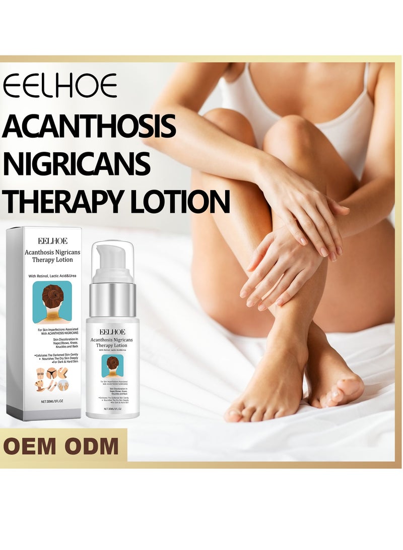 إيلهو غسول لعلاج داء الأشواك السوداء يخفف من الندوب ، وإصلاح البشرة ، وينعم البشرة . - Image 1