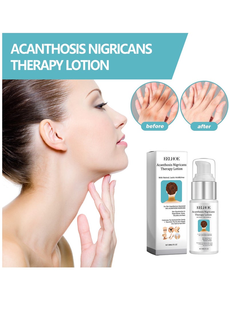 إيلهو غسول لعلاج داء الأشواك السوداء يخفف من الندوب ، وإصلاح البشرة ، وينعم البشرة . - Image 2