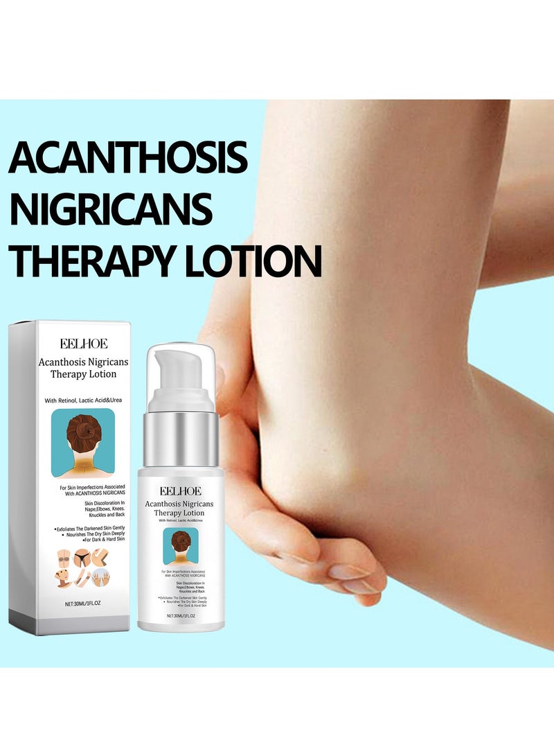 إيلهو غسول لعلاج داء الأشواك السوداء يخفف من الندوب ، وإصلاح البشرة ، وينعم البشرة . - Image 3