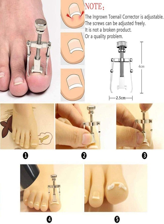 JTIEO 12-Piece Toenail Clippers Set - Ingrown Toenail Removal Kit, Heavy Duty with Silver Finish - Image 2