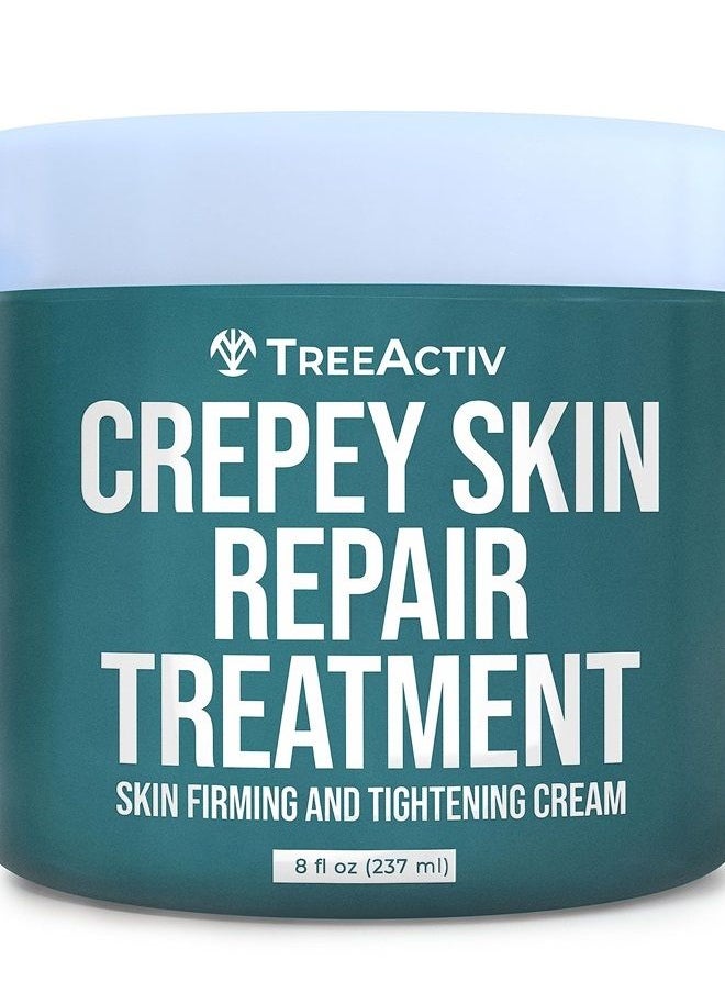 TreeActiv Crepey Skin Repair Treatment, 8oz, Firming Cream For Face and Neck, Skin Firming and Tightening Lotion with Hyaluronic Acid, Crepey Skin Treatment that Moisturizes Dry Crepe Skin, 500+ Uses  - Image 1