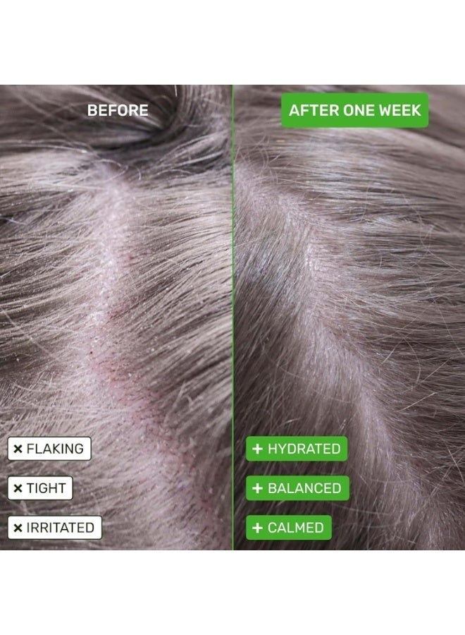 Greenlem Natural Herbal Anti-Hair Loss Shampoo Soap, Green Triangle, Scalp Care and Hair Root Strengthening - Image 3