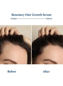 Blue Nectar Advanced Plant-Based Rosemary Hair Growth Serum Natural Alternative for Redensyl Intensive Ayurvedic Serum for Women and Men with Bhringraj 8 Herbs 100 ml  - Image 4