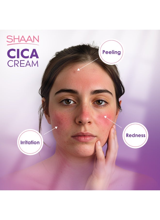 Shaan - Shaan CICA Cream 60ml - Image 1