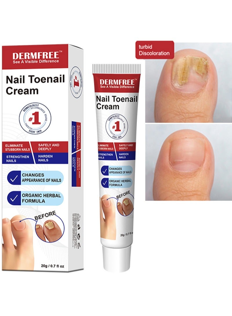 DERMFREE Nail Toenail Cream，Nail Repair Cream, 20g Nail Cream Anti Harmful Substance Repair Finger Toe Nail Care Perfect for Men and Women Home Use  - Image 1