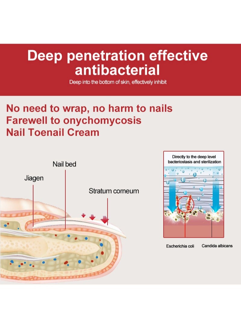 DERMFREE Nail Toenail Cream，Nail Repair Cream, 20g Nail Cream Anti Harmful Substance Repair Finger Toe Nail Care Perfect for Men and Women Home Use  - Image 4