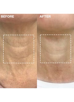 WRINKLES SCHMINKLES Wrinkles Schminkles Neck Wrinkle Patch - Reusable Silicone Smoothing Pads, Sensitively Formulated Wrinkle Patches. Reduce Wrinkles - Innovative Wrinkle Treatment - Targeting Neck Wrinkles (1 Pack)  - Image 3