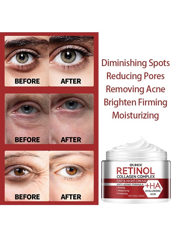 OUHOE - Retinol Collagen Complex Day & Night Cream, Anti Aging Cream With Hyaluronic Acid And Collagen, Wrinkle Removal Skin Firming Cream 30g - Image 1