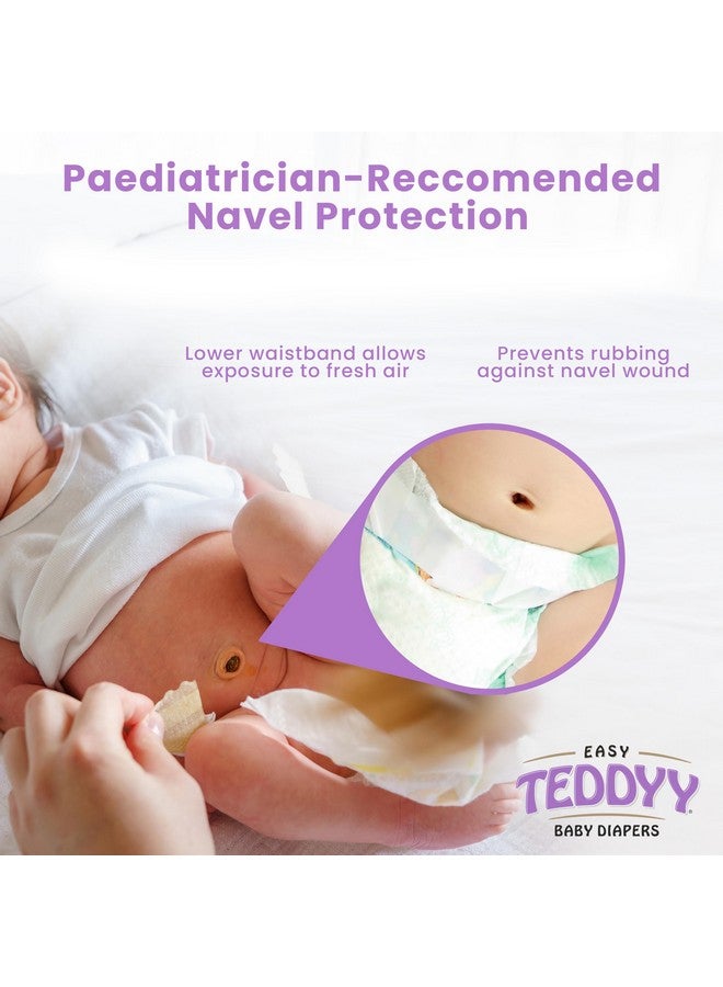تيدي حفاضات إيزي بيبي كبيرة جدًا (18-24 شهرًا) - 56 قطعة، 13-17 كجم، امتصاص طويل الأمد، مضادة للطفح الجلدي - Image 3