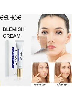 Blemish Removing Cream, Facial Oil Control Acne Cream, for Fast Acne Removal for Oily and Acne-prone Skin, Non-Irritant, Women 30g - pzsku/Z7872A5AD0CACDC3F849CZ/45/_/1702633461/3ae3594b-d8fa-47ee-9ed0-3ab483ab1128