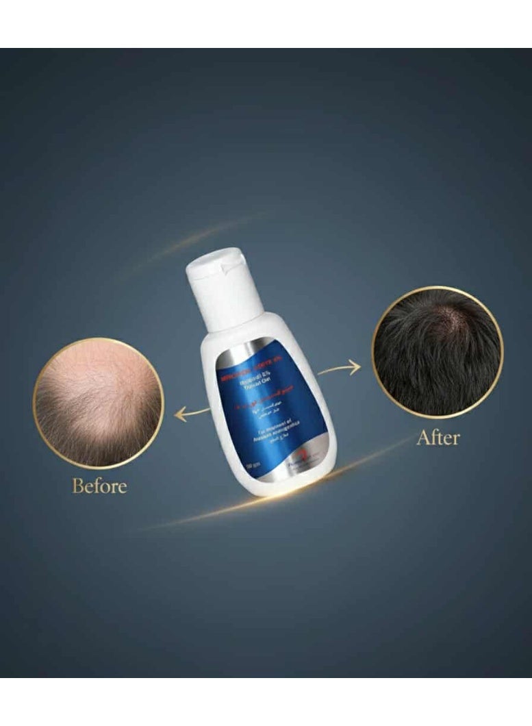 Minoxidil Forte 5% Topical Gel for Androgenetic Alopecia Treatment, 60g - Image 4