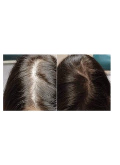 Oilex Oil Garlic ampoules for the treatment of hair loss and full capillaries, 5 Amp, ampoules of 10 ml  - Image 4