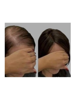 Oilex Oil Garlic ampoules for the treatment of hair loss and full capillaries, 5 Amp, ampoules of 10 ml  - Image 3