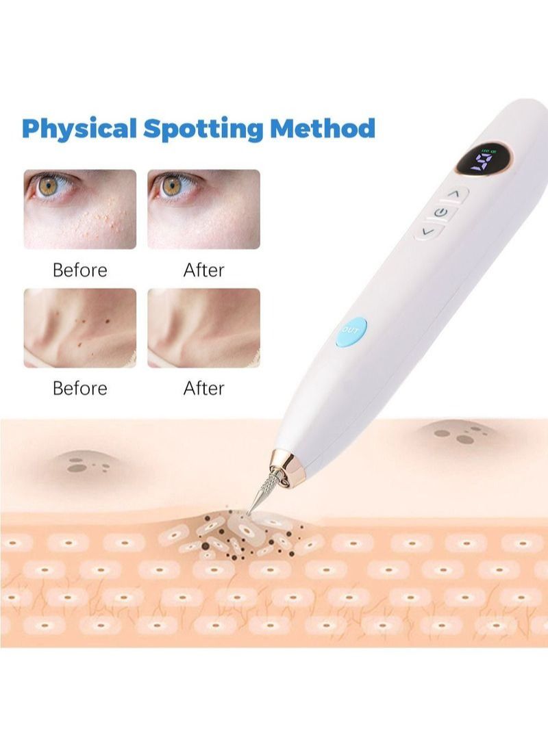 NIBEMINENT Plug-in 9-speed Laser Point Mole Pen Beauty Salon Electric Sweeping Spot Removal Granulation Tattoo Wart Spot Home Beauty - Image 4