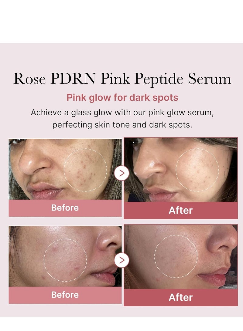 ميديكيوب pdrn الببتيد الوردي الوردي تألق جوهر ، جوهر ، الببتيد ، نيكوتيناميد ، ثبات الرطوبة ، تفاوت لون البشرة ، منتجات العناية بالبشرة الكورية | 1.01 fl.oz ( 1.01 fl.orz روز pdrn ( نباتي ) - Image 2