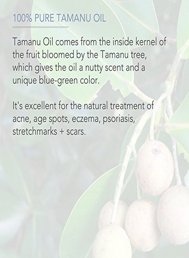 PURE BODY NATURALS U Oil For Psoriasis, Eczema, Acne Scars, Rosacea Relief For Dry, Scaly Skin, Blisters By Pure Body Naturals, 4 Fl. Ounce  - Image 5