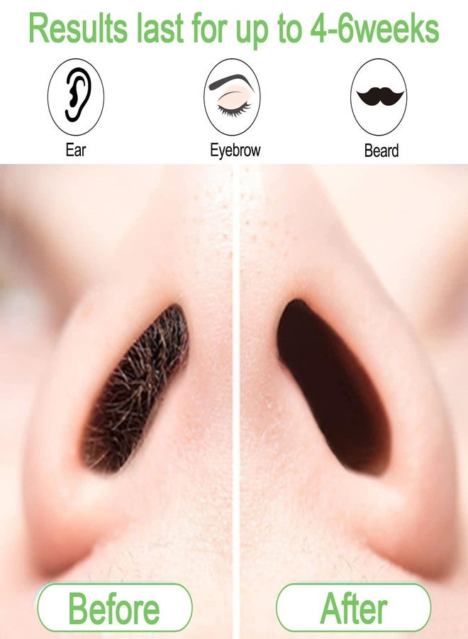 BLUETOP Nose and Ear Hair Waxing Kit - Hair Removal Set for Men and Women with 50g Wax Beads, 20 Applicators (10 times), 10 Paper Cups, and 10 Mustache Guards - Image 3