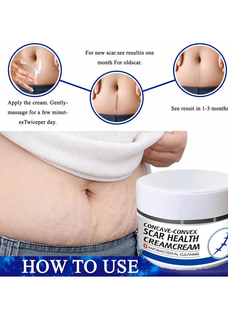 Scar Removal Cream Skin Repair Treatment  for Old and New 30g Advanced for Stretch Marks Acne C-Section Burns and Other - Image 2
