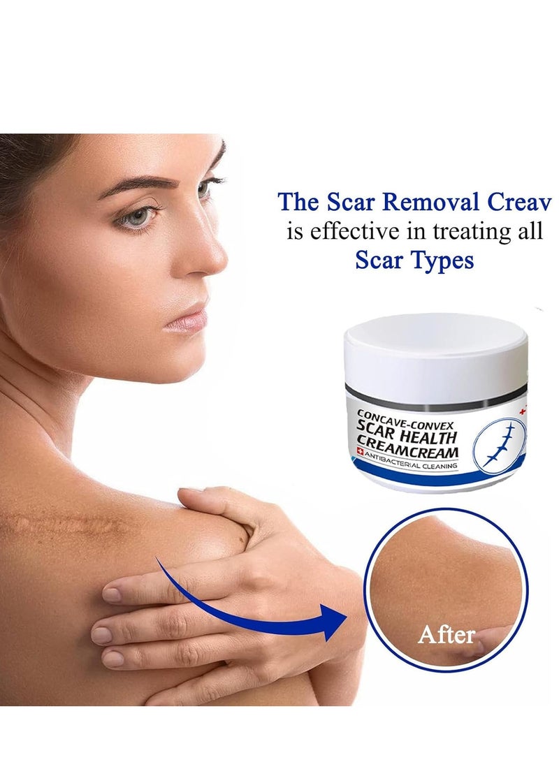 Scar Removal Cream Skin Repair Treatment  for Old and New 30g Advanced for Stretch Marks Acne C-Section Burns and Other - Image 4