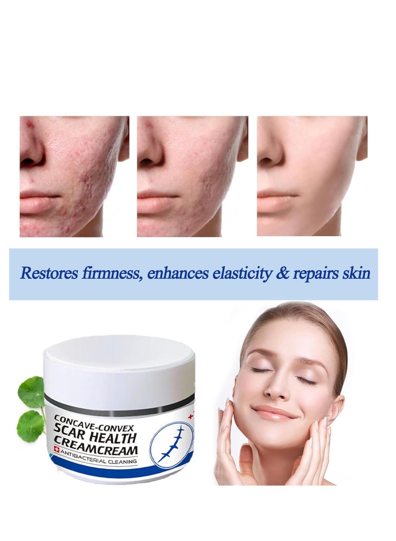 Scar Removal Cream Skin Repair Treatment  for Old and New 30g Advanced for Stretch Marks Acne C-Section Burns and Other - Image 5