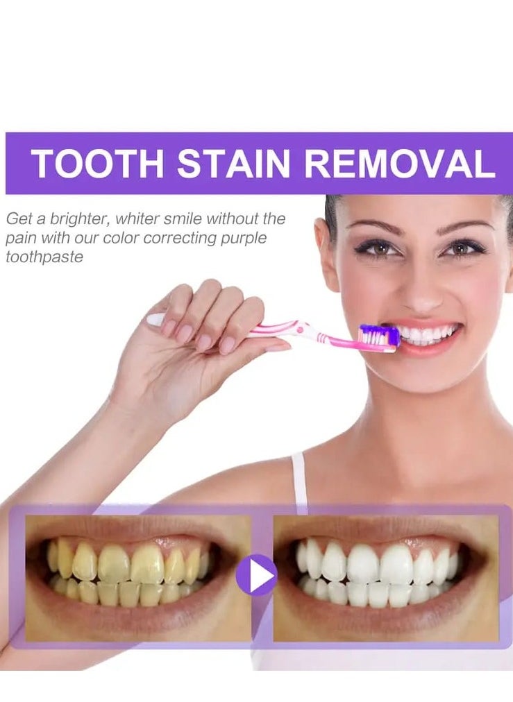 SMILEKIT v34 Colour Corrector, Purple Teeth Whitening, Tooth Stain Removal, Teeth Whitening Booster, Purple Toothpaste, Colour Correcting,  - Image 2