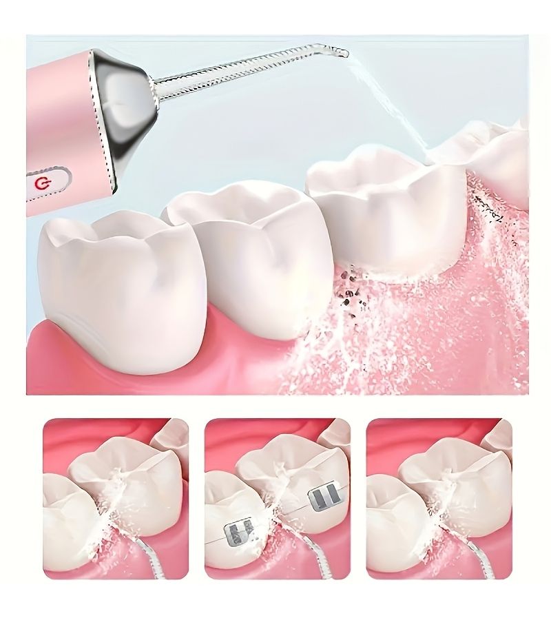 New Oral Irrigator White Cavity Cleaning 3 Modes Adjustment 4 Spray Heads USB Rechargeable 300mAh Battery 360 Degree Swivel Head - Image 4