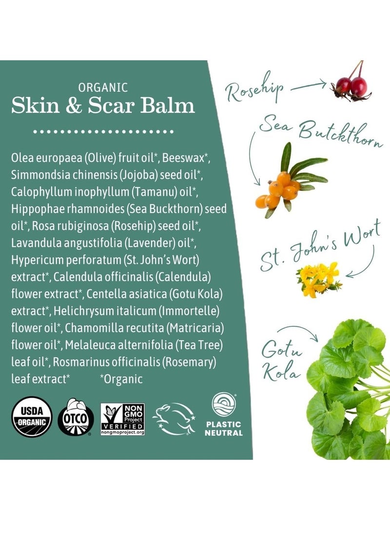 Earth Mama - Earth Mama Organic Skin & Scar Balm |C-Section Recovery Skin Care, Pregnancy Stretch Mark Scar Cream with Organic Jojoba Oil, Tamanu Oil & Gotu Kola (2-Pack) - Image 1