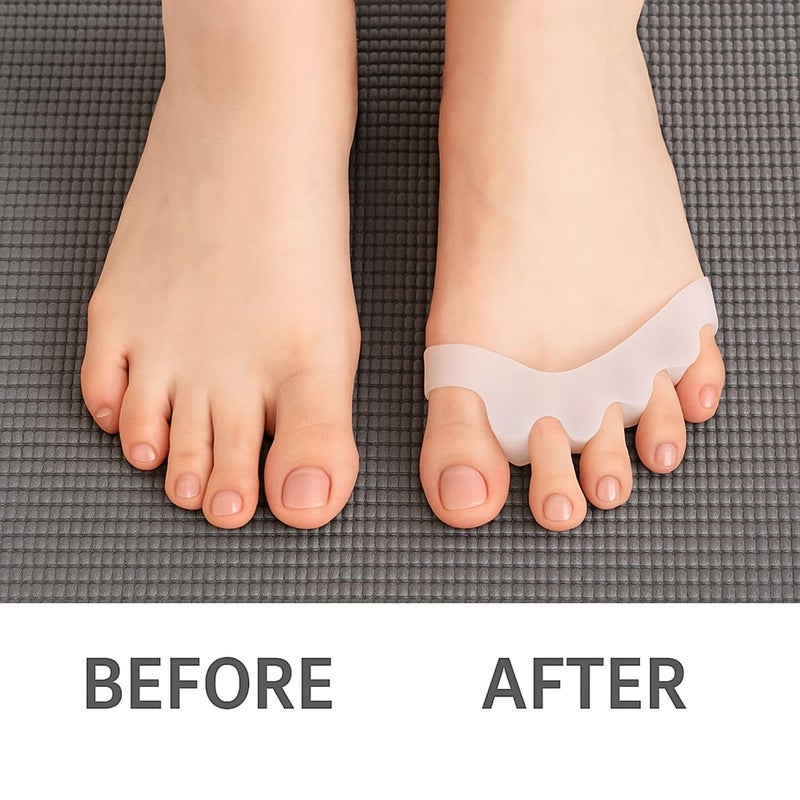 Silicone Toe Separators - All Day Comfort and Protection! - Generic - Image 3