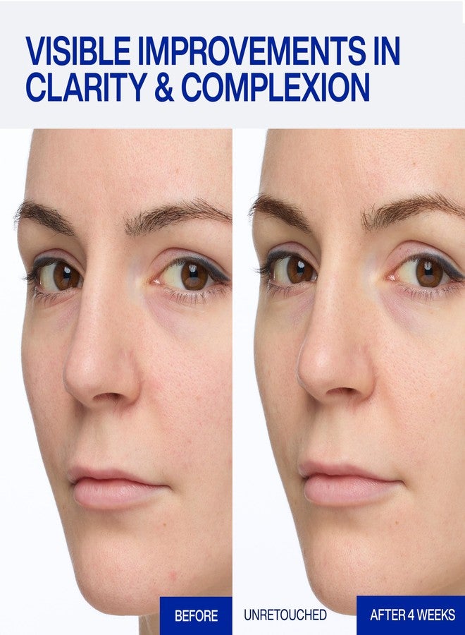 IOPE Expert Vitamin C 25% Antioxidant Serum - 25% Pure Vitamin C Face Serum - Visibly Evens Skin Tone, Enhances Radiance, and Smooths Texture – 5 Antioxidants and PHA - 0.77 fl. oz. - Image 3