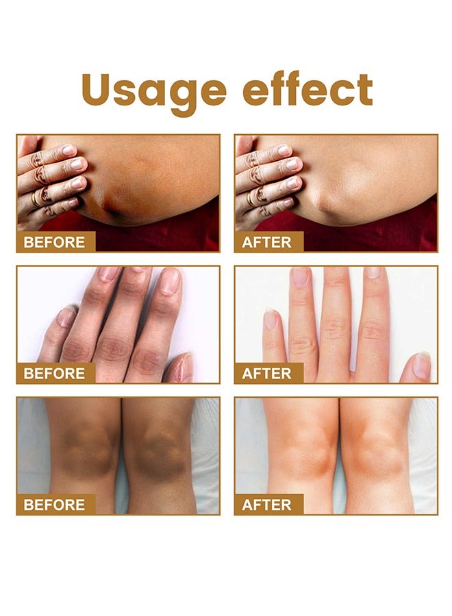 Jaysuing Therapy Drops,Dark Knuckle Whitening Serum 10 ML - Image 5