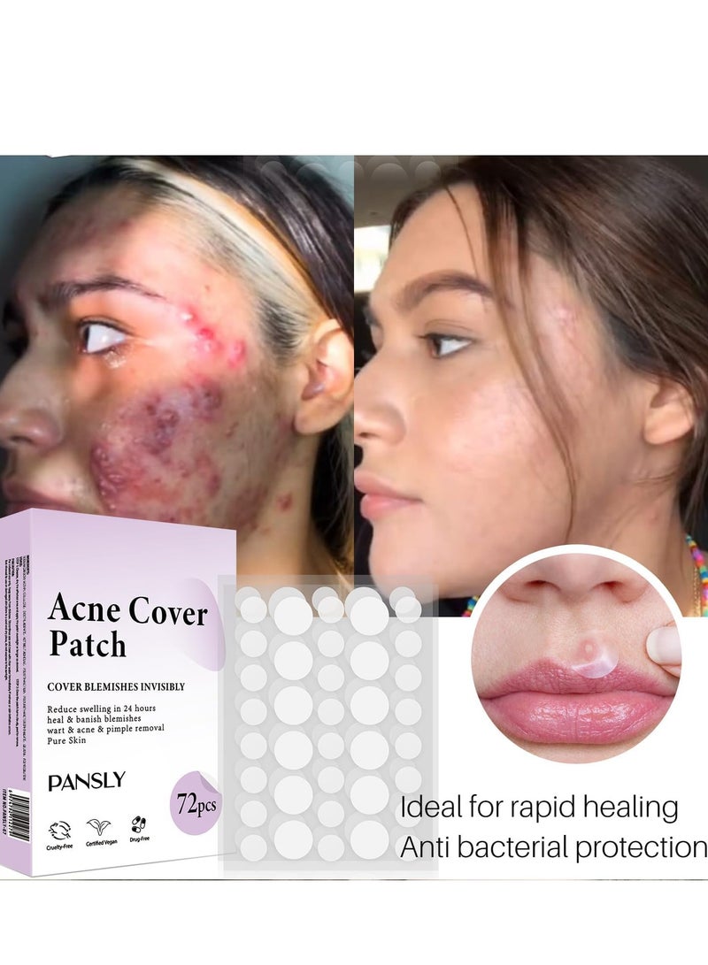 بانسلي بقع للوجه ، مستحضرات التجميل البثور التصحيح الأصلي - علاج بقع البثور ، بقع البثور غير المرئية لتغطية البقع والعيوب ، ملصق الجلد غير المرئي (72 قطعة) - Image 3