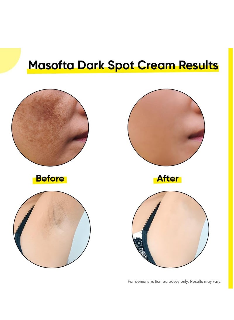 Masofta Dark Spot Reduction & Removal Cream for Pigmentation, Melasma, Acne Marks, Blemishes, Underarms, Neck, Knees & Knuckles | Dark Spot & Patch Corrector | with Kojic Acid, Alpha Arbutin & Niacinamide | For Men & Women | 50g - Image 3