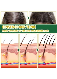 OUHOE Ginseng Essence Moisturizing Hair Mist, Rapid Growth Hair Treatment 7 Day Hair Growth Serum Essence Oil Regrow, for Women & Men 100ML  - Image 3