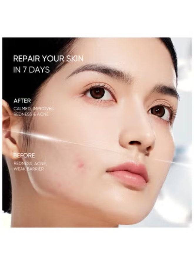 SKINTIFIC Sensitive Moisture Gel For Reduce redness Moisturizer Face Cream For Acne-Prone Skin 30g - Image 2