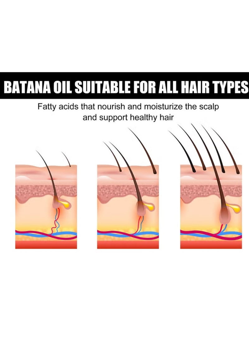 إيلهو 2 PCS زيت باتانا لنمو الشعر زيت باتانا - زيت باتانا العضوي للشعر الصحي - إصلاح الشعر المتضرر ، تغذية فروة الرأس الرقيقة الجلد وتخسيس الشعر النعار النمو لجميع أنواع الشعر - 30 مل - Image 4