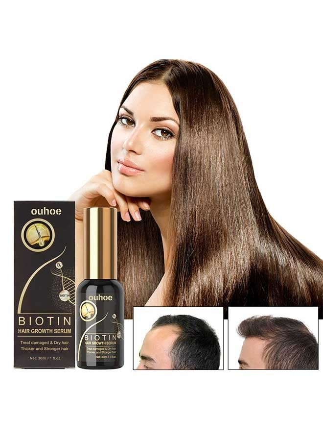 OUHOE Biotin Hair Growth Serum 30ml,Can Promote Hair Growth,Hair Repair,Strong And Fragile Hair,Suitable For All Hair Types - Image 1