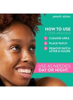 Peach Slices Deep Blemish Microdarts Acne Patch Early Stage & Deep Pimples Fastacting Salicylic Acid Tea Tree Oil Niacinamide Cica Hyaluronic Acid Spot Treatment 9 Patches  - Image 5