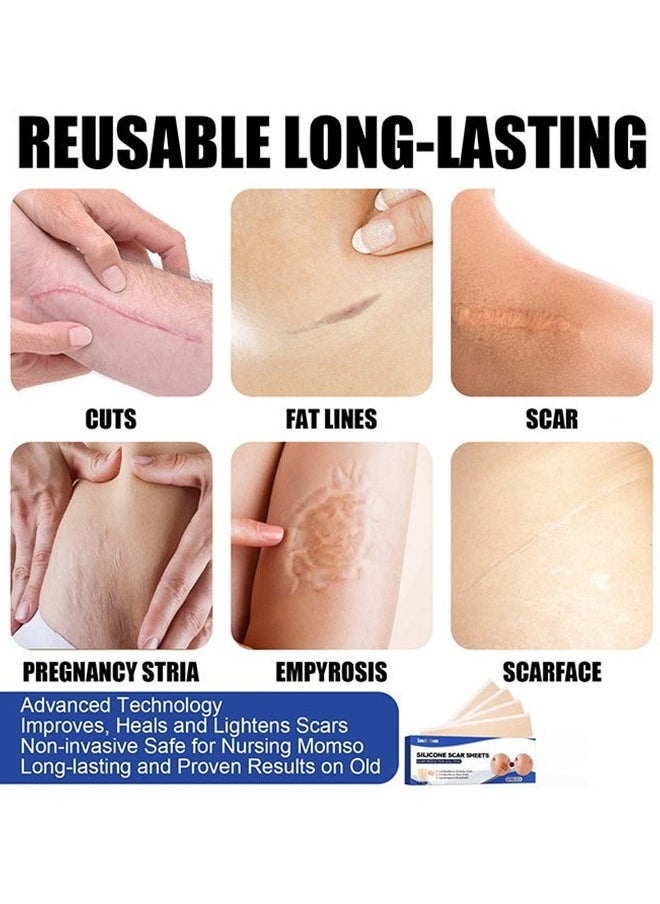 Silicone Scar Sheets—Scar Remover Patch, Silicone Scar Sheets For Scars Stretch Mark Treatment Waterproof, 4 Reusable Sheets, Size 5.9" x 1.6"