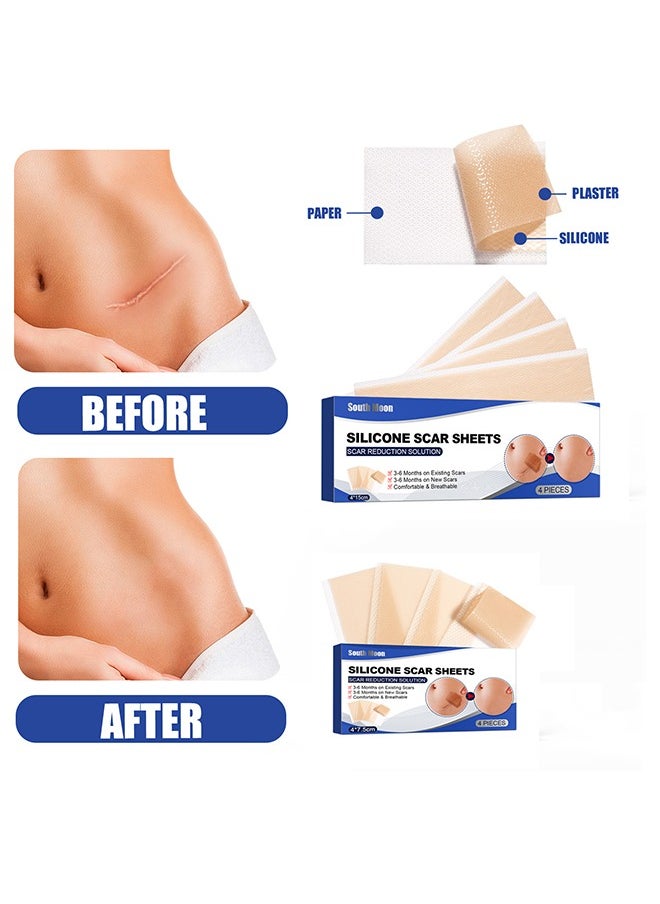 Silicone Scar Sheets—Scar Remover Patch, Silicone Scar Sheets For Scars Stretch Mark Treatment Waterproof, 4 Reusable Sheets, Size 5.9" x 1.6"