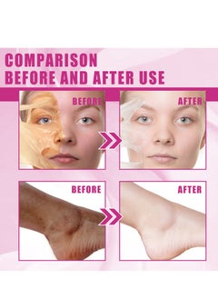 OUHOE Peeling Oil for Dark Skin, Yellow Peeling Oil with Salicylic Sodium Hyaluronate, Strong Peeling Oil Extra Strength, Exfoliating Peeling Solution for Body All Skin Type - 110ML  - Image 5