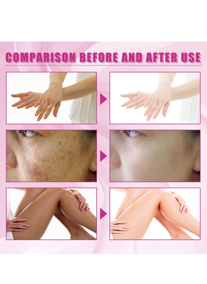 OUHOE - Peeling Oil for Dark Skin, Yellow Peeling Oil with Salicylic Sodium Hyaluronate, Strong Peeling Oil Extra Strength, Exfoliating Peeling Solution for Body All Skin Type - 110ML - Image 1