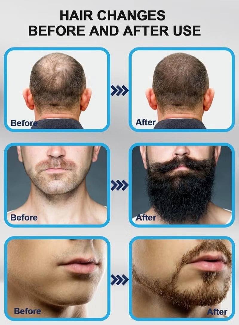 Microneedling Beauty Tool - Professional Adjustable Amazing Beauty Skinpen for Women & Men - 140-Needle Skin, Hair & Beard Care Tool for Optimal Home Use by Men & Women (White) - Image 5