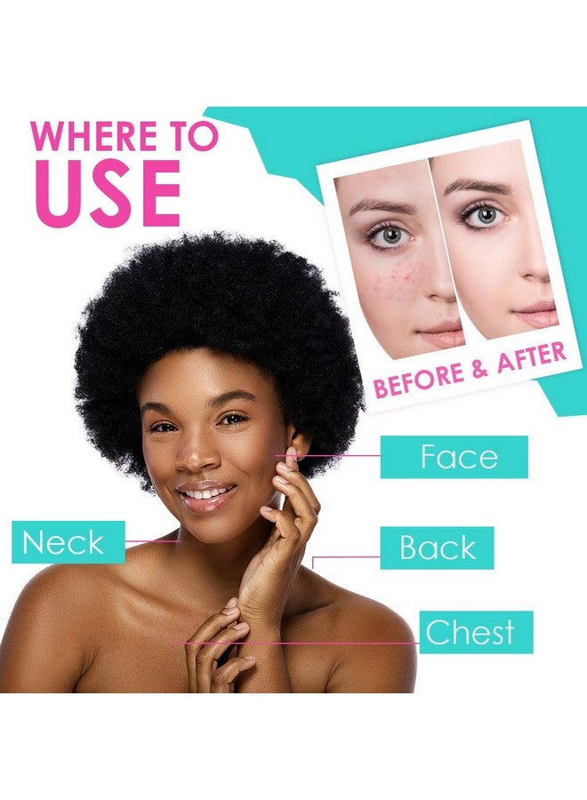 Bye Bye Blemish Acne Drying Lotion, Reduce Pimples Overnight 1Oz, 3Pack - Image 5