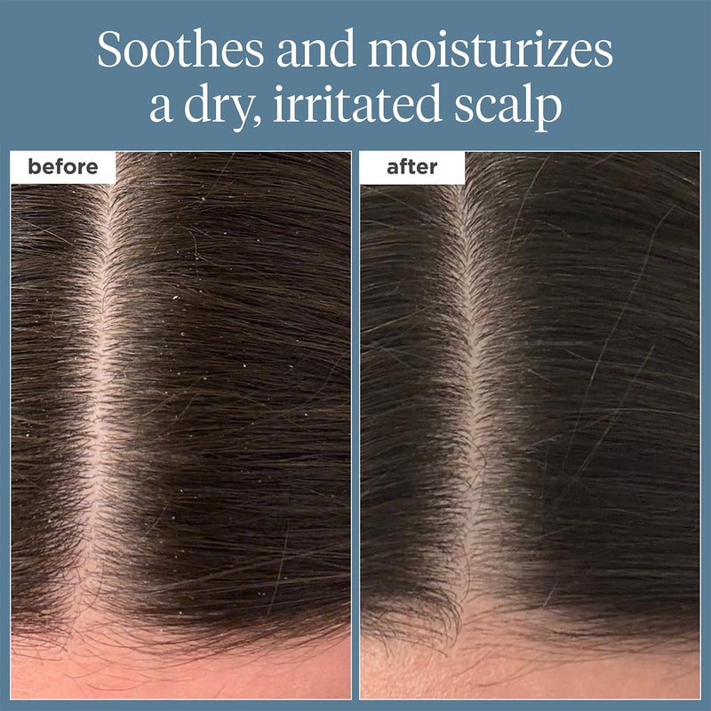 Briogeo Scalp Revival Rosemary Pre-Wash Oil, Hair and Scalp, Dry Scalp Treatment for Stronger and Longer Hair, Soothe Dry Scalp, Lipids and Vitamins, Deep Moisture, Vegan, Cruelty-Free, 1 fl oz - Image 2