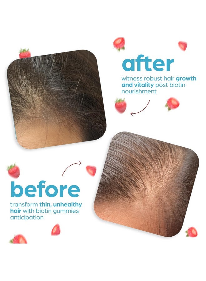 آرت ناتشورالز حلوى جيلاتين البيوتين من Artnaturals لنمو الشعر - (100 حلوى جيلاتينية - 10000 ميكروجرام) - فيتامينات الفراولة الطبيعية تدعم الأظافر والبشرة - خالية من الجيلاتين والغلوتين والمكسرات والبيض - Image 5